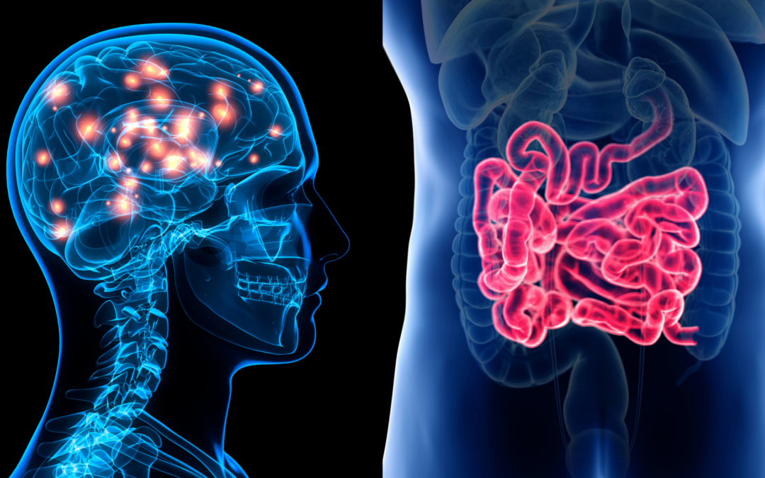 The Gut-Brain Connection And Migraine